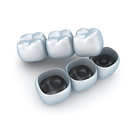 11 Versicherungen Zahnzusatzversicherung sinnvoll?